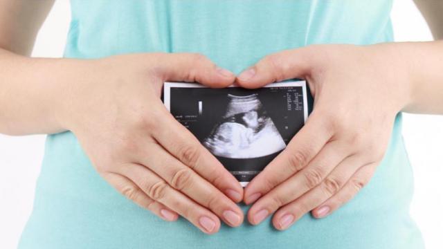 Sono View Prenatal Imaging